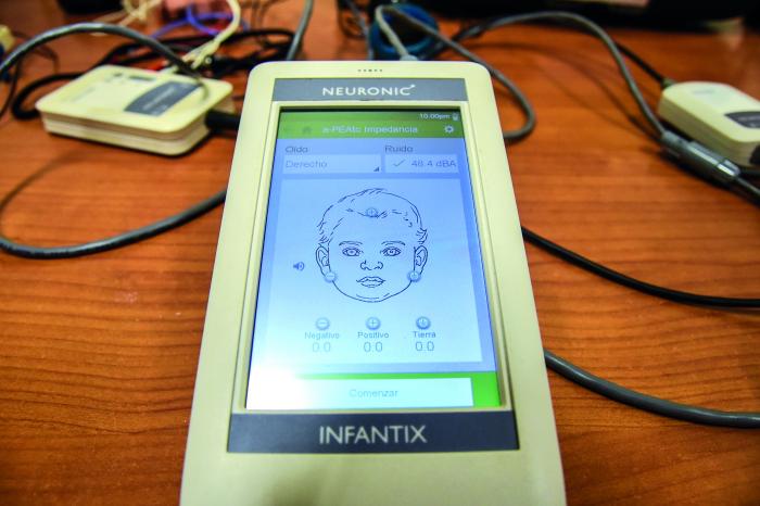 Sistema Infantix: Innovación Cubana en la Detección Temprana de Trastornos Auditivos y Visuales en Recién Nacidos 2 Sistema de audicion